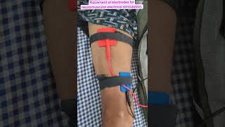 Placement of electrode for neuromuscular electrical muscle stimulation for ms reeducationshorts [upl. by Catto]