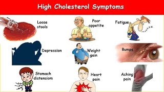 KOLESTEROLI  yndyra ne gjak  HDL  LDL  Cholesterol kolesterol kolesterolinegjak analiza [upl. by Cressy995]