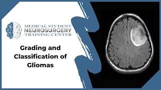 Grading and Classification of Gliomas [upl. by Winnick]