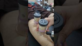 Moxibustion cupping for calfpainkneepainbackpainsciaticahipshoulderpain and blood circulation [upl. by Lebezej]