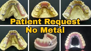 Flexible Dentures Metal Free by DatuAmbasTv [upl. by Shugart777]