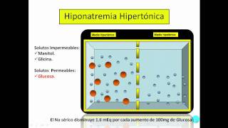 Hiponatremia Parte No1mp4 [upl. by Brit1]