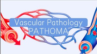 Vasculitis part 22 PATHOMA Beurger diseaseSmall vessel vasculitis [upl. by Crespi]