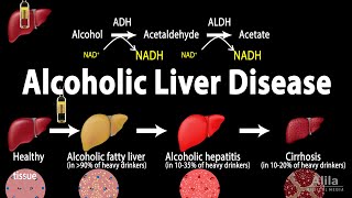 Alcoholic Liver Disease Animation [upl. by Silera]