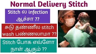 Episiotomy stitch cure tips tamil [upl. by Oirad]