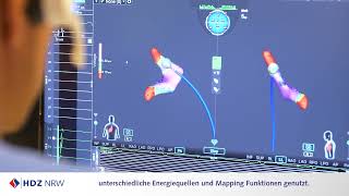 Vorhofflimmern Spezialisten am HDZ NRW setzen neuartige Ablationstechnologie ein [upl. by Wooldridge443]