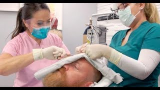 Dr Pimple Popper bursts monster cyst that wouldnt stop growing for 18 years  News Today [upl. by Nonnahsed]