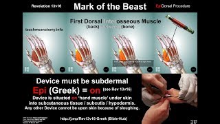 SICARII LIVE MARK OF THE BEAST DEBATE [upl. by Leunamme801]