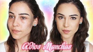 Como cubrir paño manchas y Lunar Nevus de ota con maquillaje  Isa Tips [upl. by Kaye804]