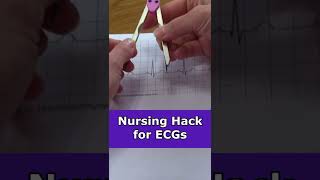 Nursing Hack for ECG Interpretation Calipers shorts  Nurse Hacks [upl. by Nanah]