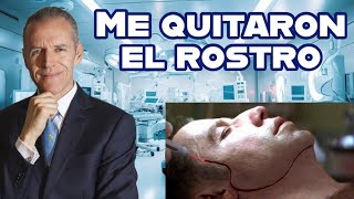 quotMe quitaron la cara del rostro para poder arreglar la fracturaquot [upl. by Hadleigh]