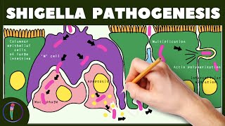 Shigella Pathogenesis Simplified [upl. by Goerke]