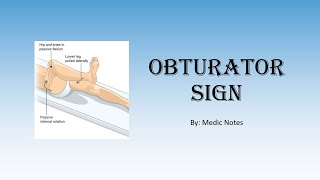 Obturator sign pathophysiology [upl. by Ahsaeyt]