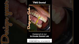 FMS Dental  Best Cosmetic Dental Clinic in Hyderabad  Smile Correction [upl. by Sybyl]