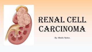 Renal cell carcinoma kidney cancer  signs and symptoms TNM staging investigation treatment [upl. by Eahsal929]