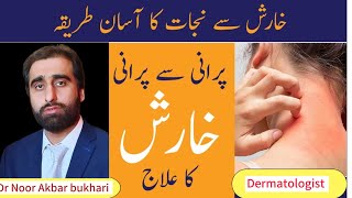 KHARISH KA ILAJ  Scabies Treatment In Urdu  Kharish Khatam Karne Ka Tarika [upl. by Ahsyia]