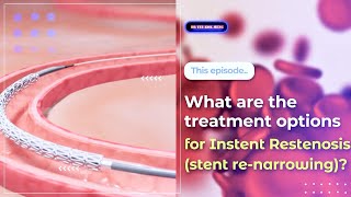 What are the treatment options for Instent Restenosis stent renarrowing [upl. by Yraunaj518]