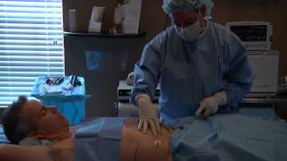 Vaser Liposuction  SmartLipo [upl. by Htebharas567]