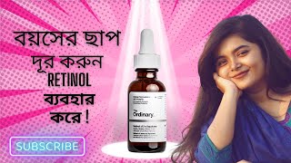 The Ordinary Retinol 1 in Squalane  Bangla Review  Zohurana [upl. by Ranna149]