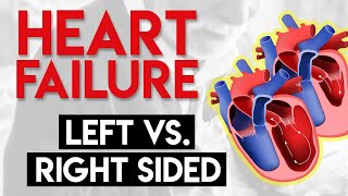 Left vs Right Heart Failure  Heart Failure Part 3 [upl. by Eerdua742]