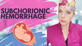 What is a subchorionic hemorrhage or hematoma [upl. by Jurkoic901]