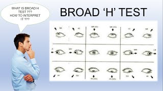 Broad H Test  Ocular Motility Test [upl. by Maxey246]