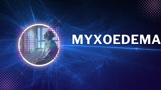 Myxoedema [upl. by Yert690]