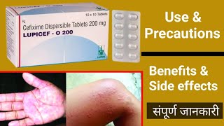 LUPICEF O tablets benefits dose amp side effects full details in hindi [upl. by Alram290]