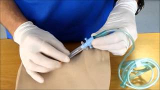 Needle Cricothyroidotomy [upl. by Allekram]