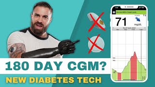 NEW Diabetes Tech  Eversense 180 day Continuous Glucose Monitormore accurate than Dexcom amp Libre [upl. by Suanne]