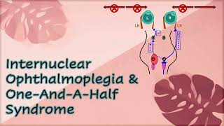 Internuclear Ophthalmoplegia amp One And A Half Syndrome [upl. by Lletnohs]