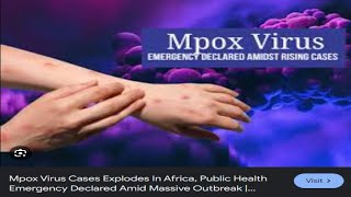 Swedens Radical Mpox Treatment A Controversial Cure [upl. by Netsyrc]