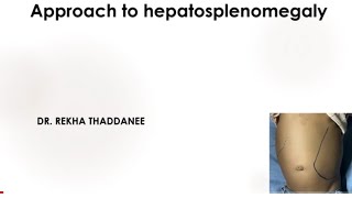 Approach to Hepatosplenomegaly Part 12  Palpation of Liver amp Spleen  Pediatrics [upl. by Fortin124]