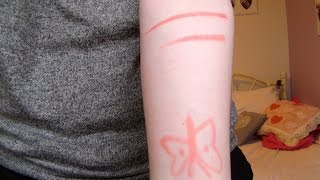 Alternatives To Self Harm [upl. by Silvana]