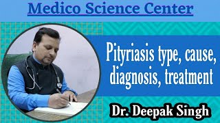 Pityriasis type cause diagnosis treatment  सिहुली DrDeepak Singh [upl. by Nocam]