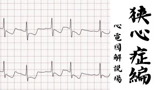 心電図解説場（狭心症編） [upl. by Marrissa547]