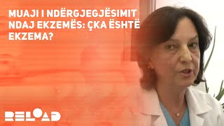 Muaji i ndërgjegjësimit ndaj ekzemës Çka është ekzema  Laura Pajaziti  Dermatologe [upl. by Hcardahs691]