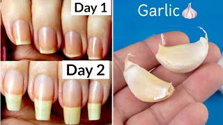 How to Grow Nails in 2 Days  How to Grow Nails Fast  jyoticachauhan [upl. by Isyad971]