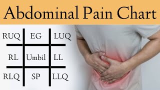 Abdominal Pain Causes by Location and Quadrant Differential Diagnosis Chart [upl. by Earahc538]