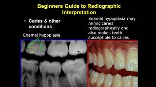 Radiographic Interpretation Section 2 [upl. by Cecil894]