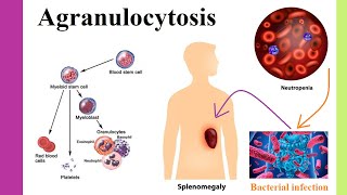 agranulocytosis [upl. by Ona]