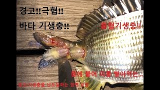 극혐 바다 기생충 물고기에서 떼어내기Parasite removal [upl. by Reginauld]