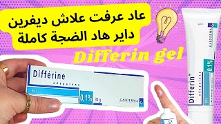 تجربتي مع differin gel  ديفرين للوجه [upl. by Nytsirc149]