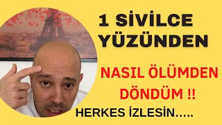 Yüzünüzdeki Sivilcelerle Oynamayın  Sivilce Nasıl Geçer [upl. by Ashatan]