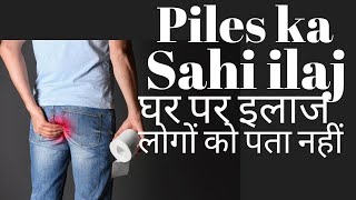 Piles treatment at home in Hindi  Bavasir ka ilaj [upl. by Aileahcim]