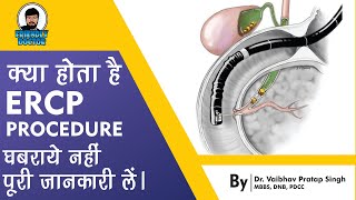 What is ERCP Procedure   ERCP Procedure in hindi [upl. by Claudina]