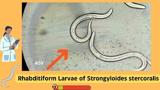 Understanding Strongyloides Rhabditiform Larvae A Comprehensive Guide  Parasitology [upl. by Fraase]