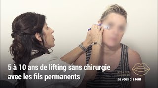 LIFTING SANS CHIRURGIE  Pose des fils tenseurs permanents Thread amp Lift [upl. by Waring]