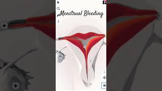 MENSTRUAL BLEEDING IN 3d menstruation shorts menstrualcycle short viral mc dr shortvideo [upl. by Akemot]