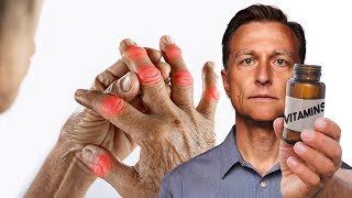 The 1 Best Vitamin for Arthritis NOT VITAMIN D [upl. by Esor328]